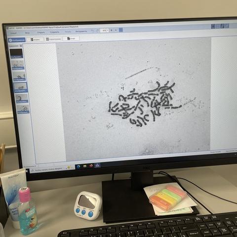 Karyotype analysis software showing a chromosome spread from a MenSC sample