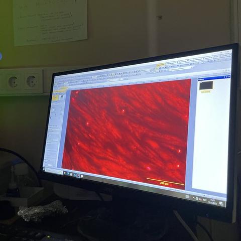 Fluorescent microscopy image showing red-stained cytoskeletal structures